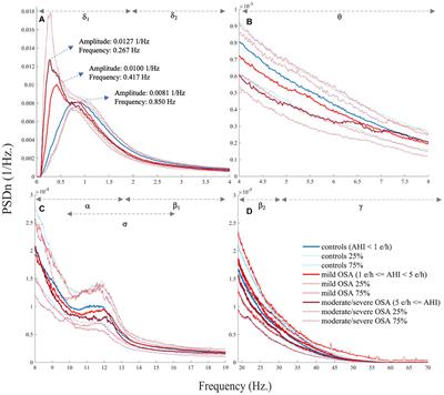 Pediatric Sleep Apnea: The Overnight Electroencephalogram as a Phenotypic Biomarker